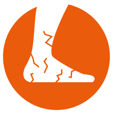MROWIENIE, DRĘTWIENIE